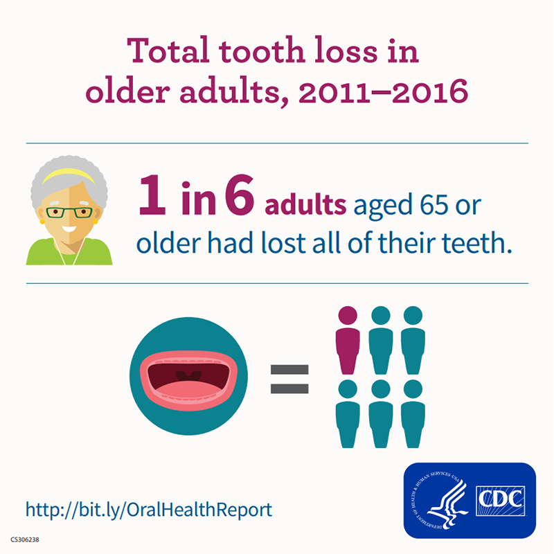 The infographic explains that from 2011 to 2016, total tooth loss was common in older adults. It says that 1 in 6 adults aged 65 or older had lost all their teeth. There is a drawing of an open mouth next to six human‑shaped icons, with one highlighted to show the statistic. A small illustration of an older adult’s face is at the top, and CDC logos and a link to a report appear at the bottom.